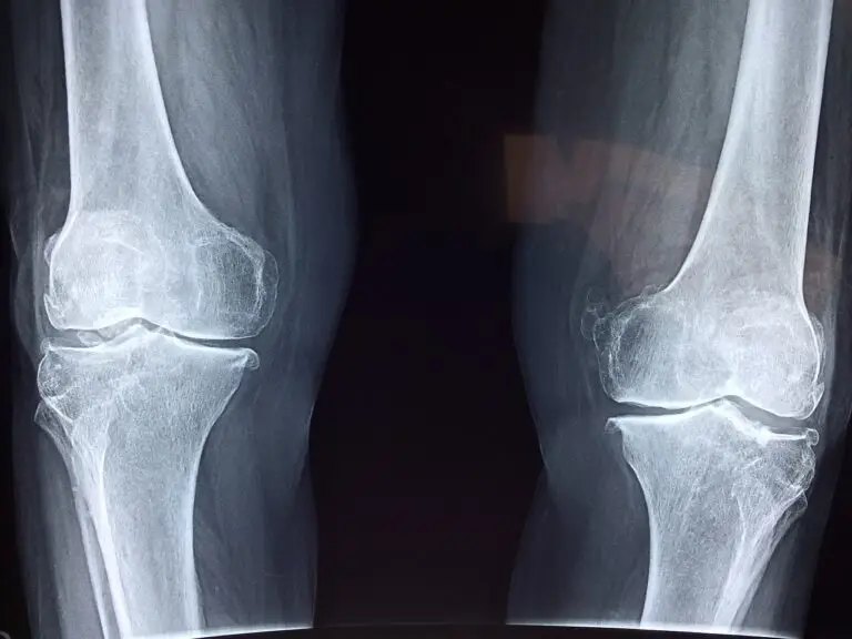 X-ray youth sports injury